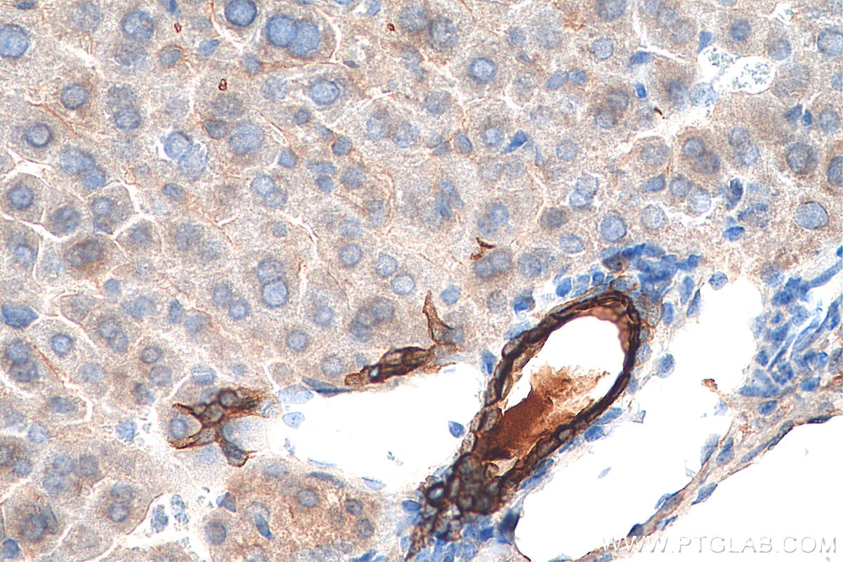 Immunohistochemistry (IHC) staining of mouse liver tissue using Cytokeratin 19 Polyclonal antibody (10712-1-AP)