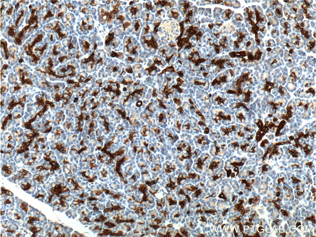 Immunohistochemistry (IHC) staining of human pancreas tissue using Cytokeratin 19 Polyclonal antibody (10712-1-AP)