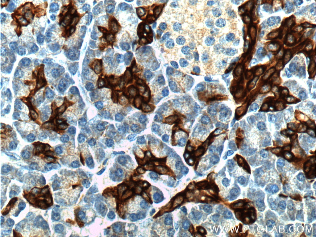 Immunohistochemistry (IHC) staining of human pancreas tissue using Cytokeratin 19 Polyclonal antibody (10712-1-AP)