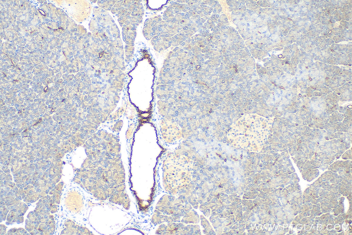 Immunohistochemistry (IHC) staining of mouse pancreas tissue using Cytokeratin 19 Polyclonal antibody (10712-1-AP)