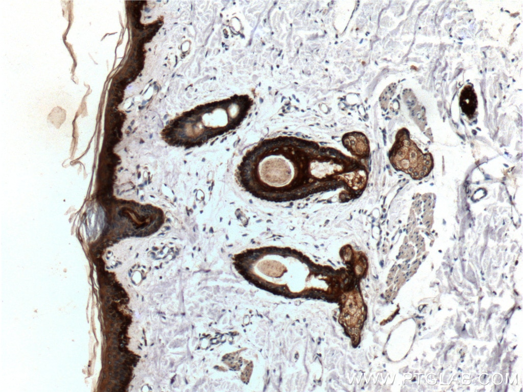 Immunohistochemistry (IHC) staining of human skin tissue using Cytokeratin 19 Polyclonal antibody (10712-1-AP)