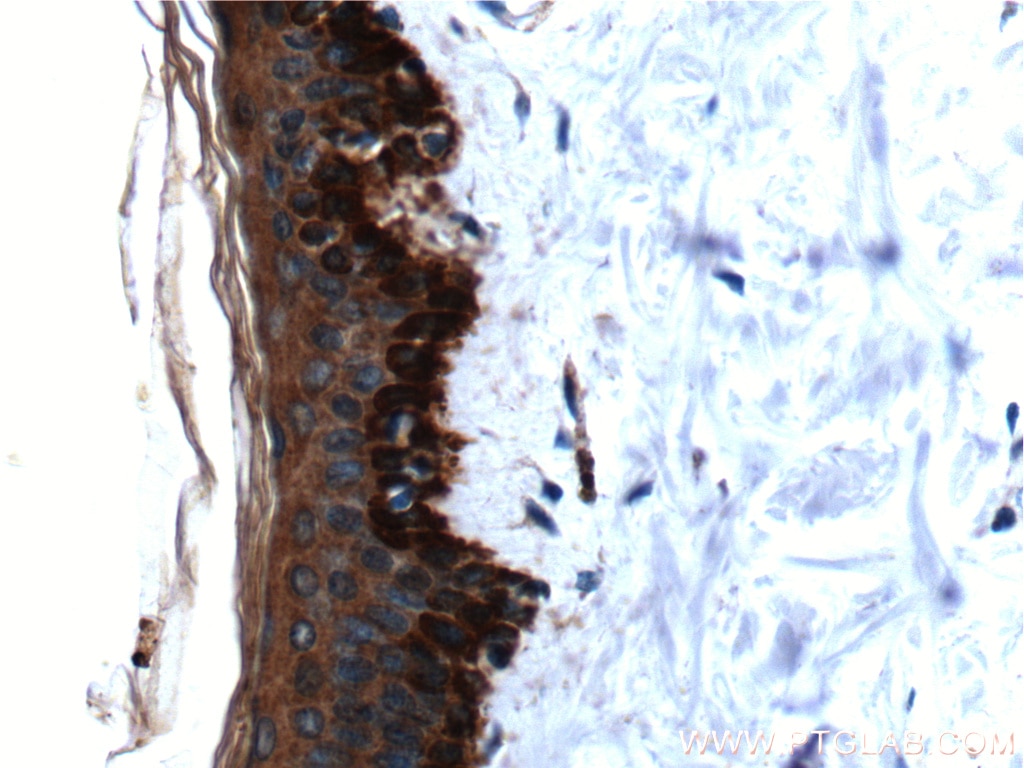 Immunohistochemistry (IHC) staining of human skin tissue using Cytokeratin 19 Polyclonal antibody (10712-1-AP)
