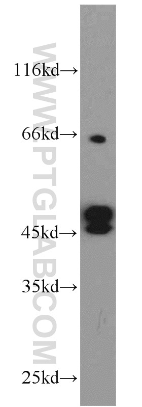 Western Blot (WB) analysis of MCF-7 cells using Cytokeratin 19 Polyclonal antibody (10712-1-AP)