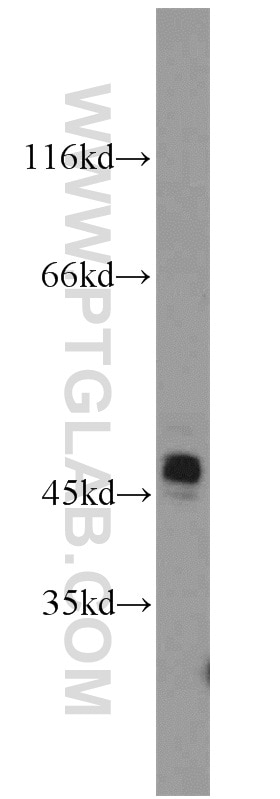 Western Blot (WB) analysis of mouse brain tissue using Cytokeratin 19 Polyclonal antibody (10712-1-AP)