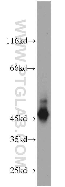 Western Blot (WB) analysis of A549 cells using Cytokeratin 19 Polyclonal antibody (10712-1-AP)