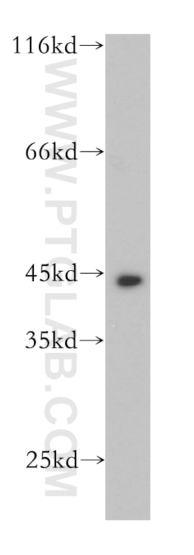 Western Blot (WB) analysis of A431 cells using Cytokeratin 19 Polyclonal antibody (10712-1-AP)