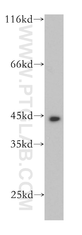 WB analysis of A431 using 10712-1-AP