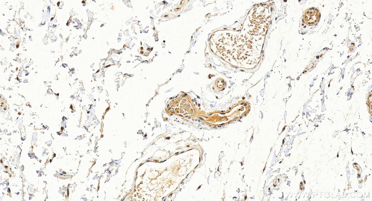Immunohistochemistry (IHC) staining of human colon tissue using Cytokeratin 19 Polyclonal antibody (14965-1-AP)