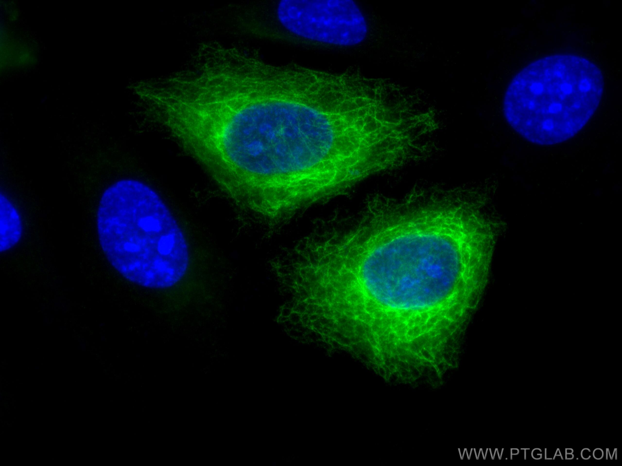 Cytokeratin 19