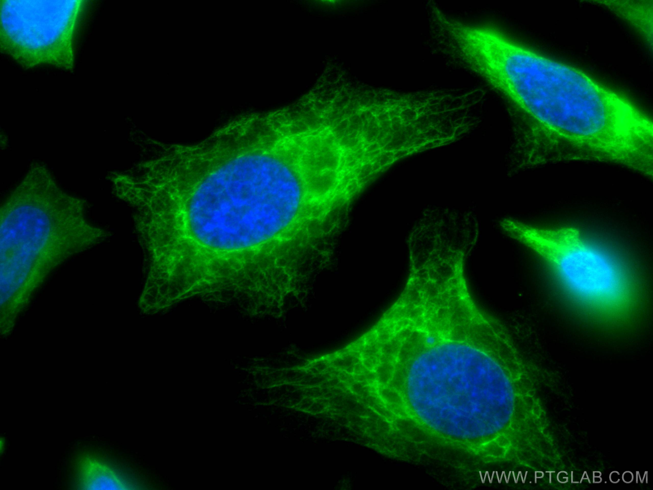 Immunofluorescence (IF) / fluorescent staining of HeLa cells using Cytokeratin 19 Polyclonal antibody (14965-1-AP)