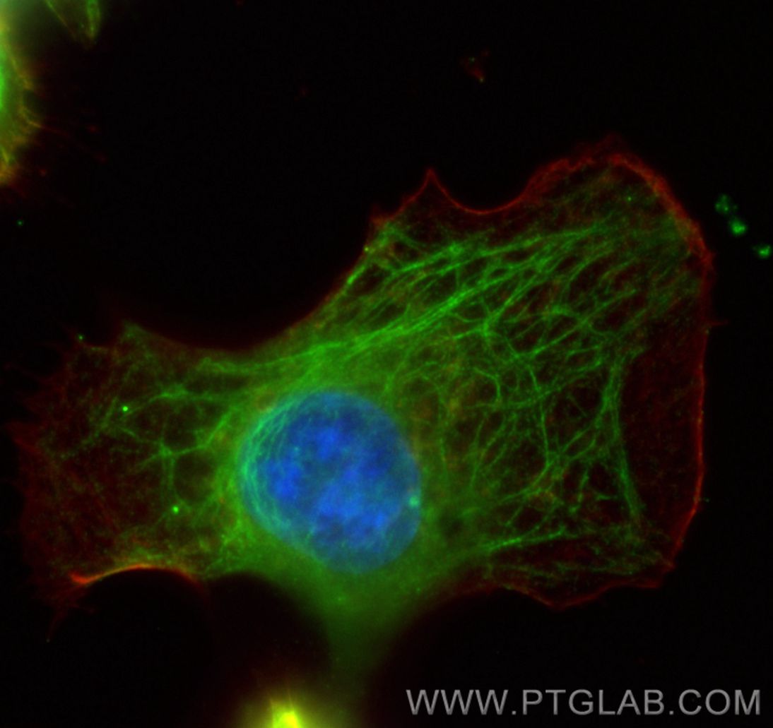 Immunofluorescence (IF) / fluorescent staining of A431 cells using Cytokeratin 19 Polyclonal antibody (14965-1-AP)