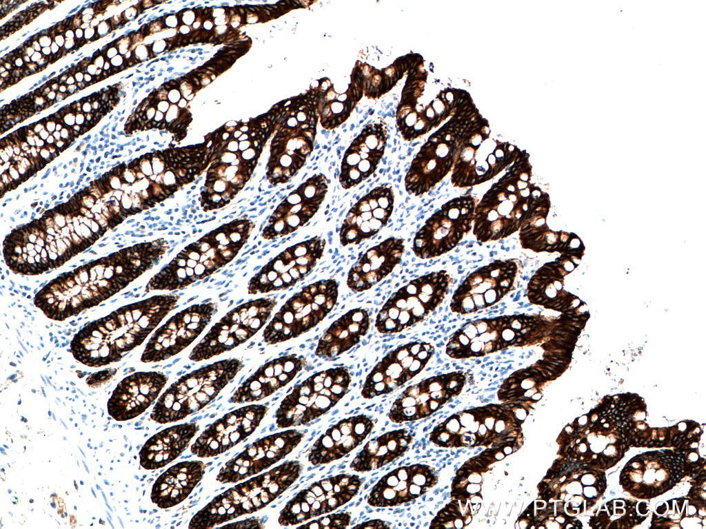 Immunohistochemistry (IHC) staining of human colon tissue using Cytokeratin 19 Polyclonal antibody (14965-1-AP)