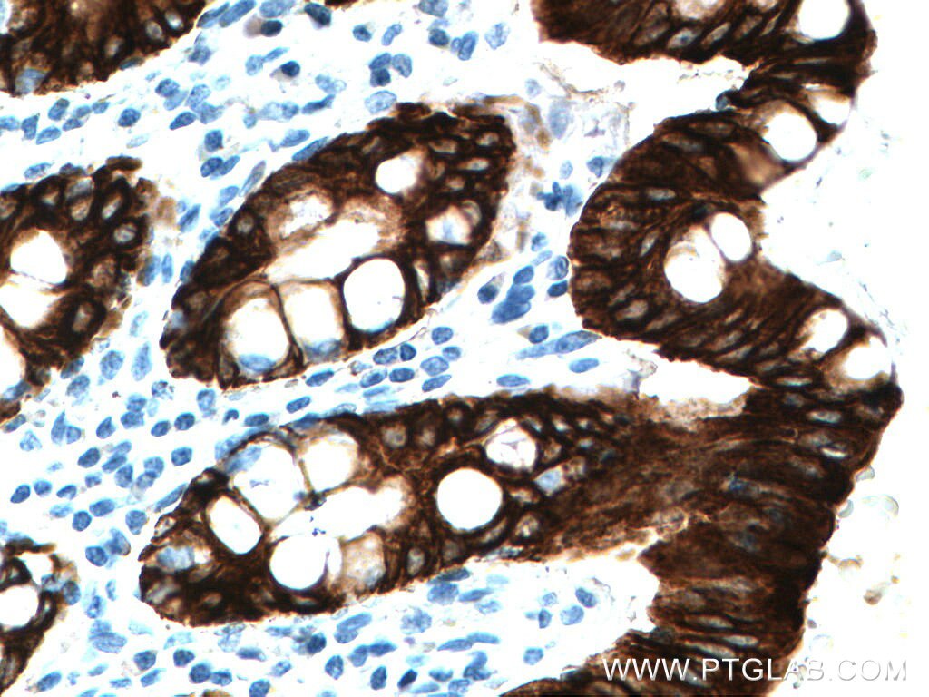 IHC staining of human colon using 14965-1-AP