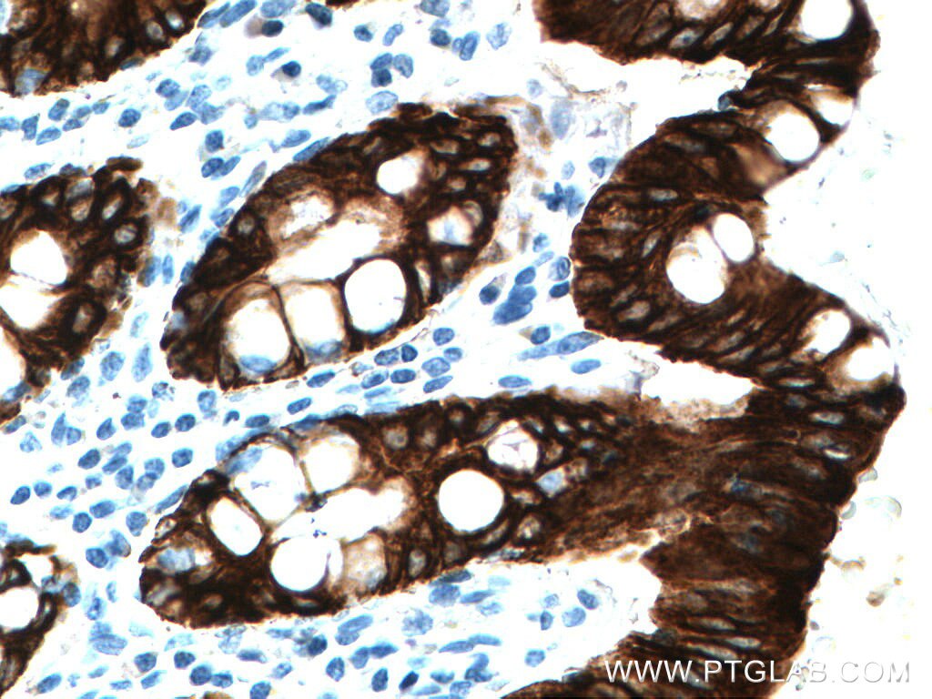 Immunohistochemistry (IHC) staining of human colon tissue using Cytokeratin 19 Polyclonal antibody (14965-1-AP)