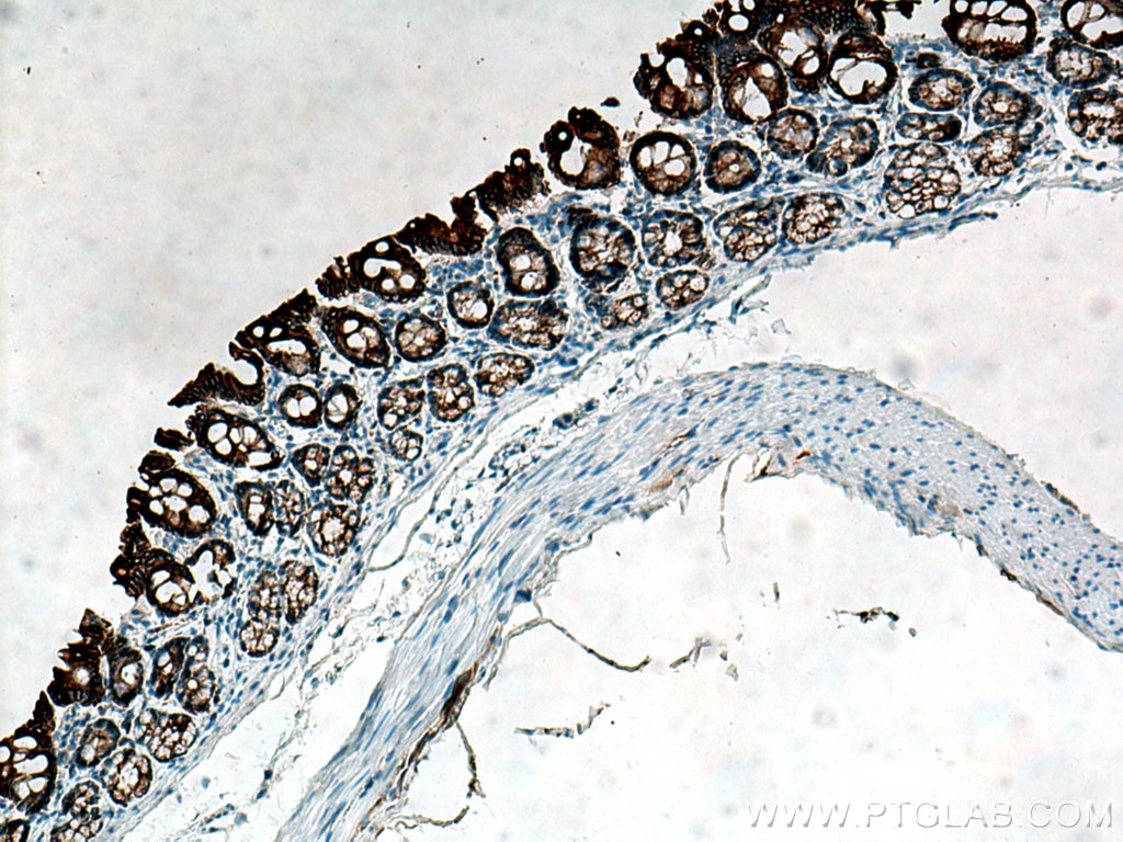 Immunohistochemistry (IHC) staining of rat colon tissue using Cytokeratin 19 Polyclonal antibody (14965-1-AP)