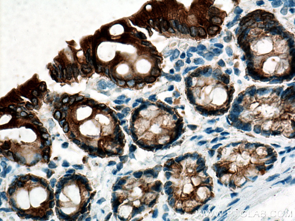 Immunohistochemistry (IHC) staining of rat colon tissue using Cytokeratin 19 Polyclonal antibody (14965-1-AP)