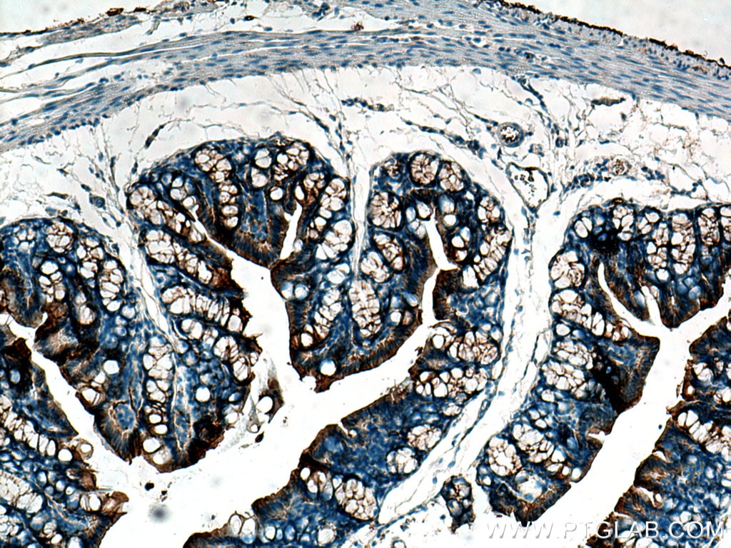 Immunohistochemistry (IHC) staining of mouse colon tissue using Cytokeratin 19 Polyclonal antibody (14965-1-AP)