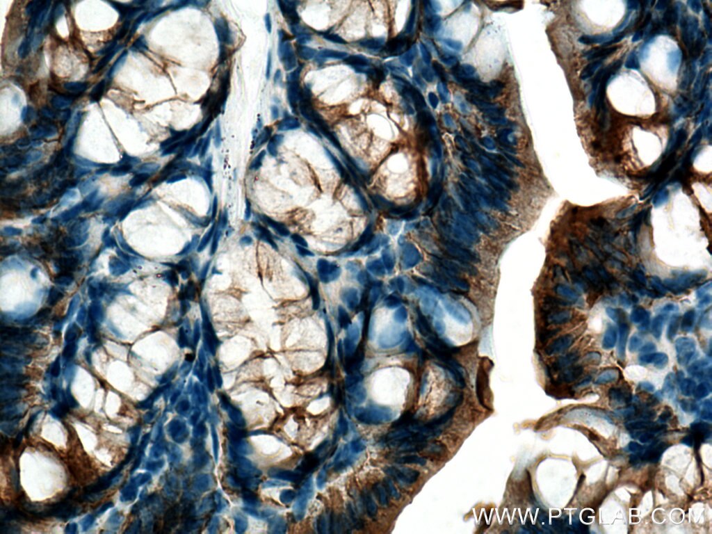 Immunohistochemistry (IHC) staining of mouse colon tissue using Cytokeratin 19 Polyclonal antibody (14965-1-AP)