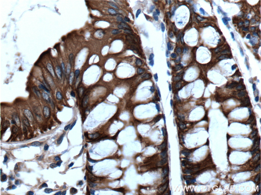 Immunohistochemistry (IHC) staining of human colon tissue using Cytokeratin 19 Polyclonal antibody (14965-1-AP)
