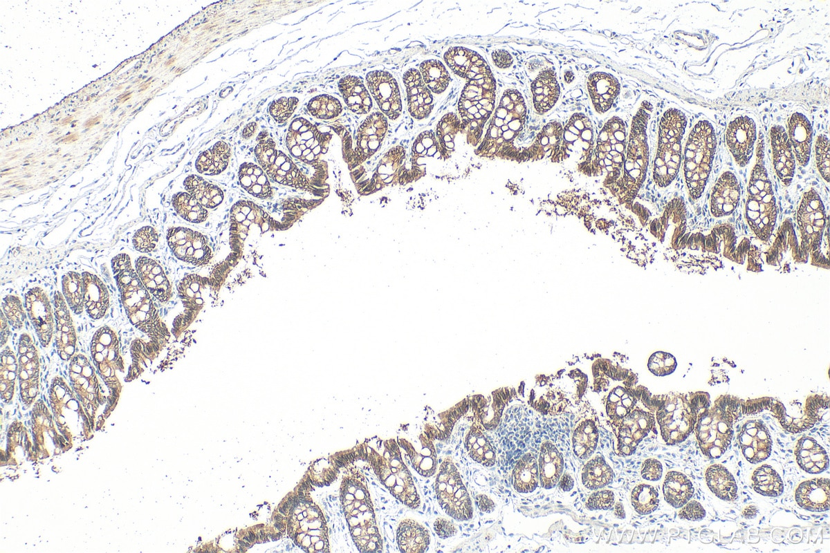 Immunohistochemistry (IHC) staining of rat colon tissue using Cytokeratin 19 Polyclonal antibody (14965-1-AP)