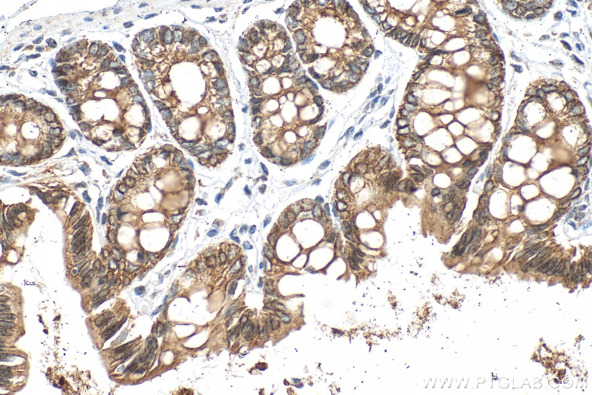 Immunohistochemistry (IHC) staining of rat colon tissue using Cytokeratin 19 Polyclonal antibody (14965-1-AP)
