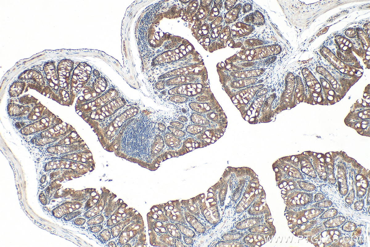 Immunohistochemistry (IHC) staining of mouse colon tissue using Cytokeratin 19 Polyclonal antibody (14965-1-AP)