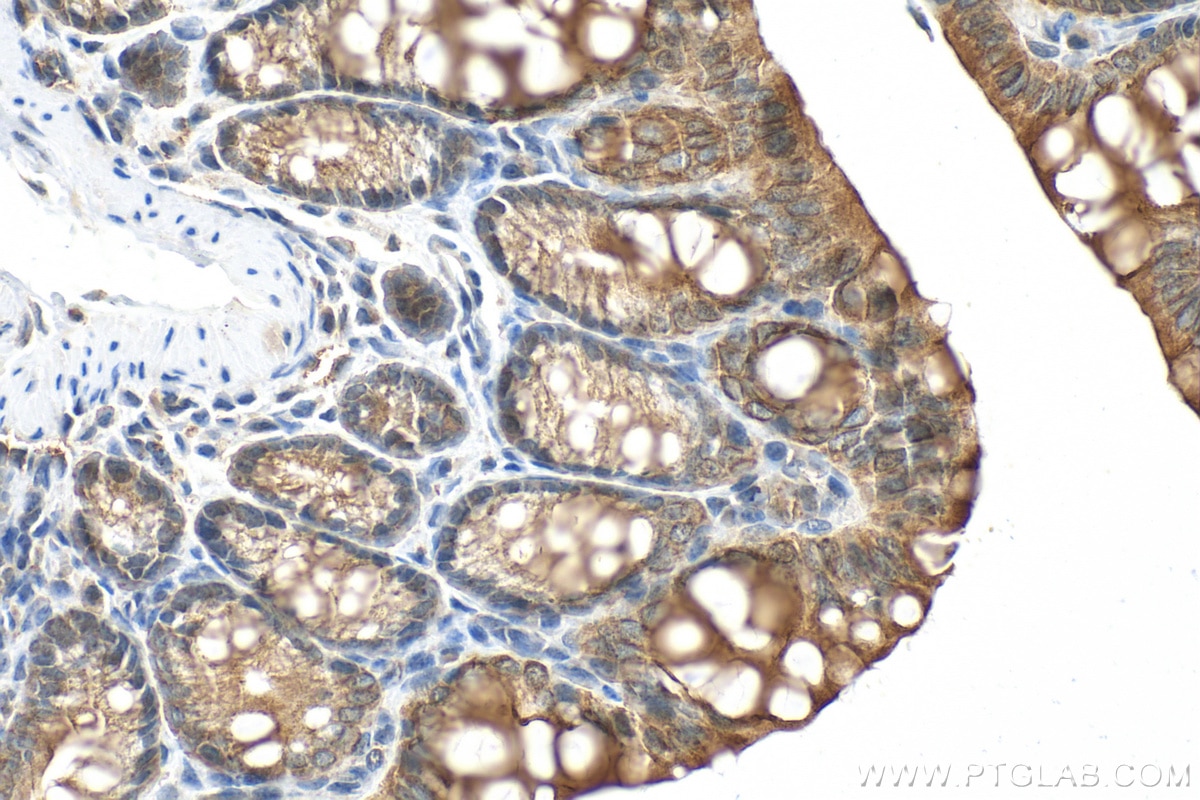 Immunohistochemistry (IHC) staining of mouse colon tissue using Cytokeratin 19 Polyclonal antibody (14965-1-AP)