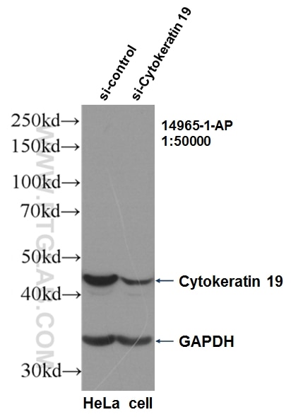 Western Blot (WB) analysis of HeLa cells using Cytokeratin 19 Polyclonal antibody (14965-1-AP)