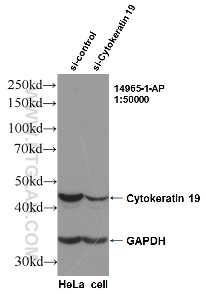 WB analysis of HeLa using 14965-1-AP