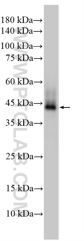 Western Blot (WB) analysis of various lysates using Cytokeratin 19 Polyclonal antibody (14965-1-AP)