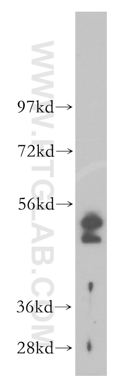 Western Blot (WB) analysis of BxPC-3 cells using Cytokeratin 19 Polyclonal antibody (14965-1-AP)