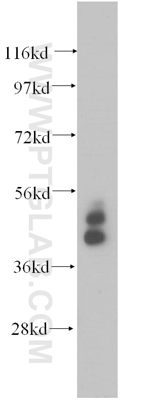 Western Blot (WB) analysis of MCF-7 cells using Cytokeratin 19 Polyclonal antibody (14965-1-AP)