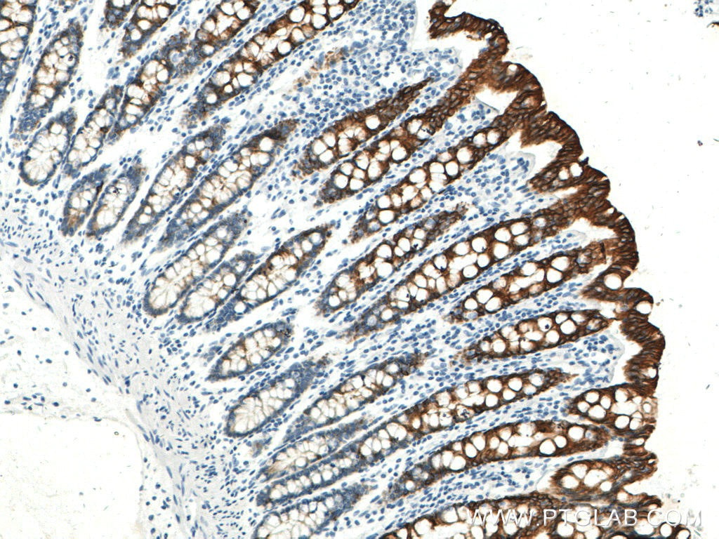 Immunohistochemistry (IHC) staining of human colon tissue using Cytokeratin 19 Monoclonal antibody (60187-1-Ig)