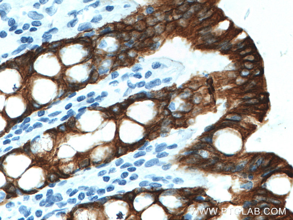 Immunohistochemistry (IHC) staining of human colon tissue using Cytokeratin 19 Monoclonal antibody (60187-1-Ig)