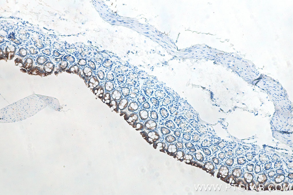 IHC staining of rat colon using 60187-1-Ig Immunohistochemistry (IHC) staining of rat colon tissue using Cytokeratin 19 Monoclonal antibody (60187-1-Ig)