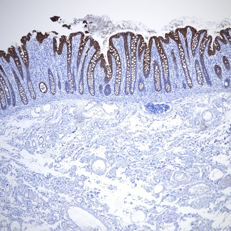 Immunohistochemistry (IHC) staining of human colon tissue using Cytokeratin 19 Monoclonal antibody (60187-1-Ig)