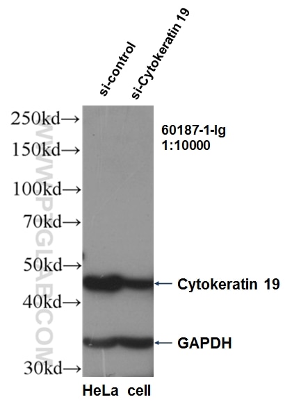 Western Blot (WB) analysis of HeLa cells using Cytokeratin 19 Monoclonal antibody (60187-1-Ig)