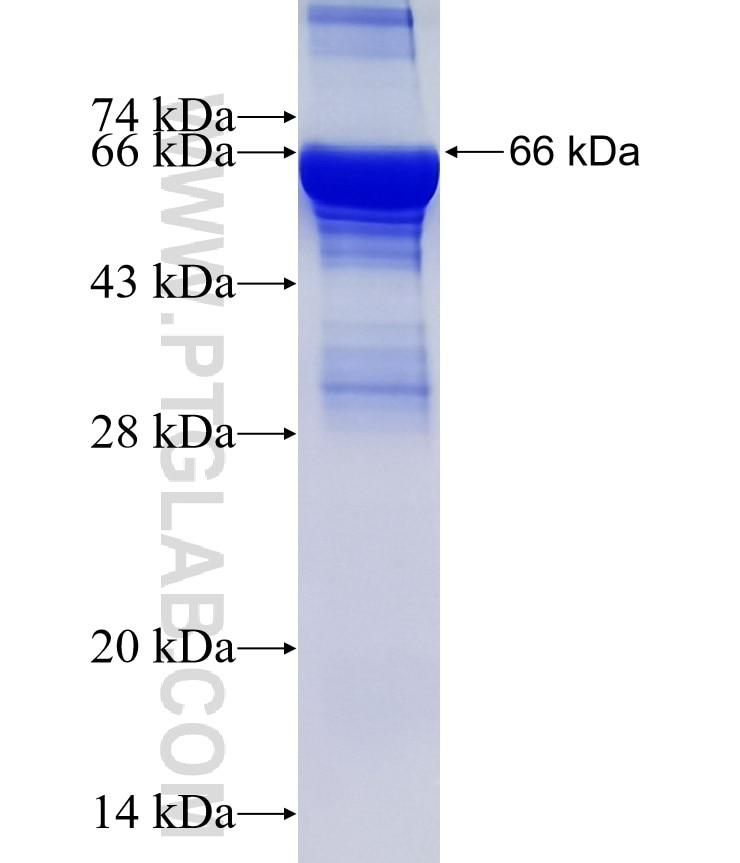 KRT19 fusion protein Ag31469 SDS-PAGE