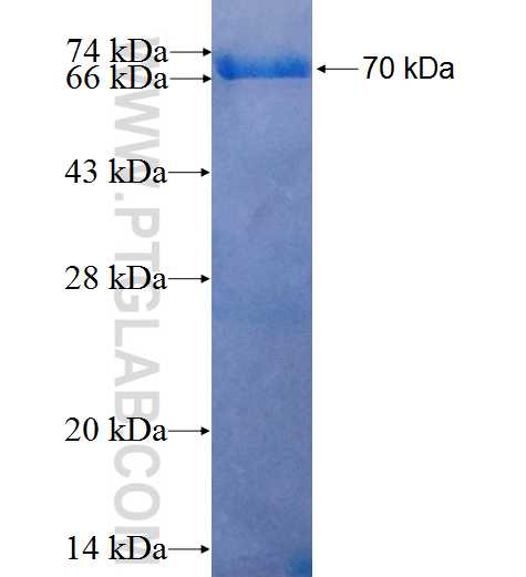 KRT19 fusion protein Ag6830 SDS-PAGE