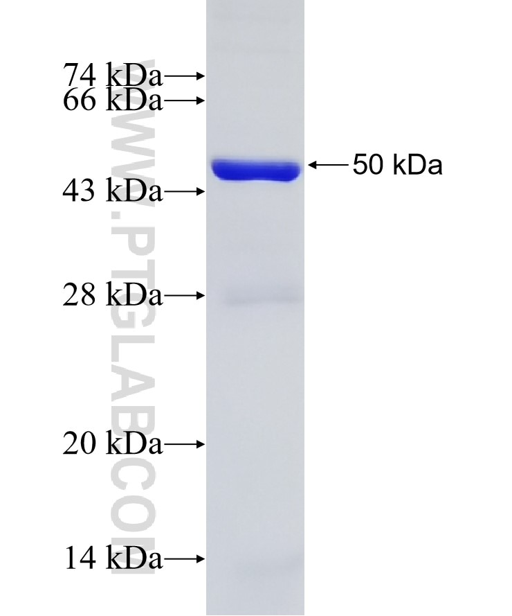 KRT19 fusion protein Ag7407 SDS-PAGE