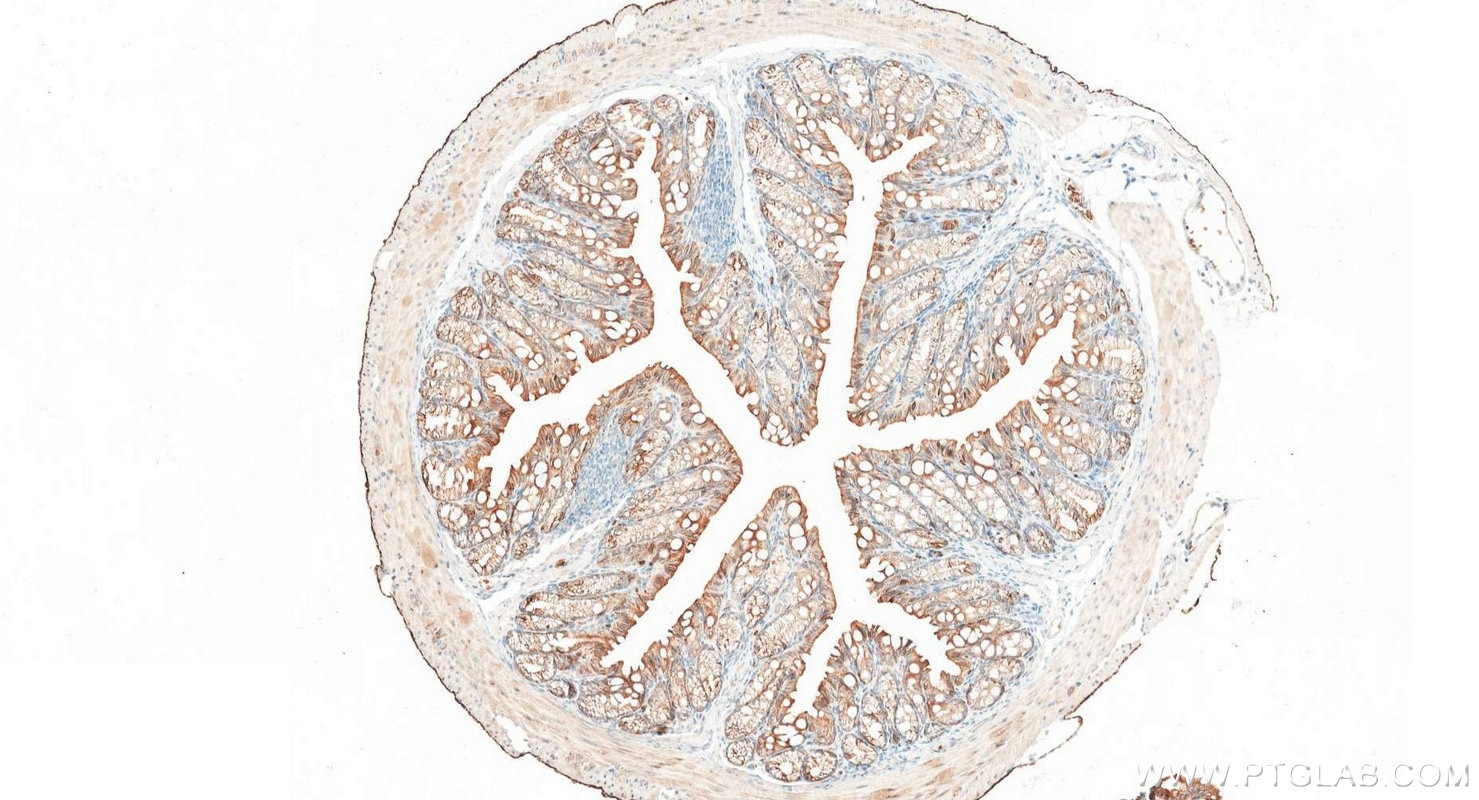 Immunohistochemistry (IHC) staining of mouse colon tissue using Cytokeratin 2e Polyclonal antibody (21725-1-AP)