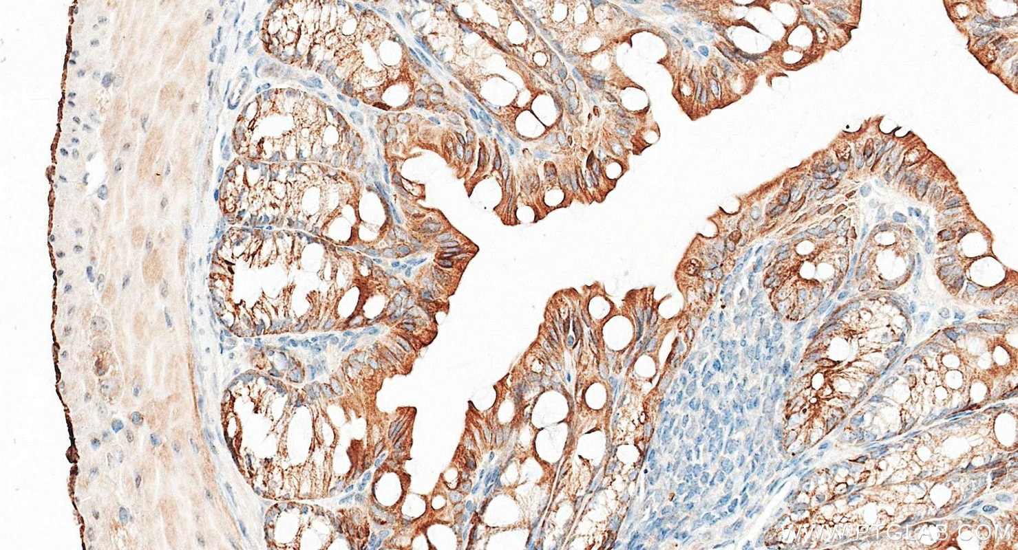 Immunohistochemistry (IHC) staining of mouse colon tissue using Cytokeratin 2e Polyclonal antibody (21725-1-AP)
