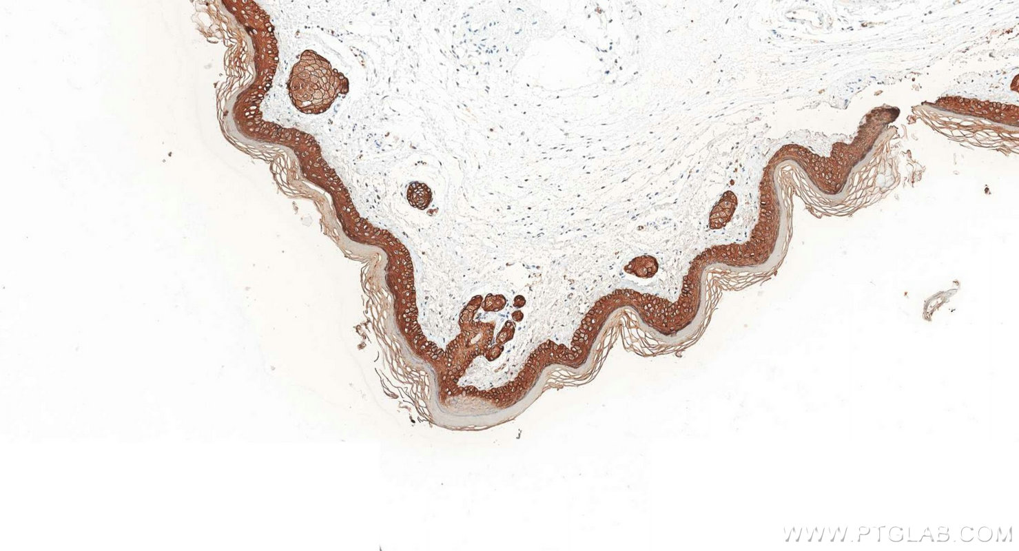 Immunohistochemistry (IHC) staining of mouse skin tissue using Cytokeratin 2e Polyclonal antibody (21725-1-AP)