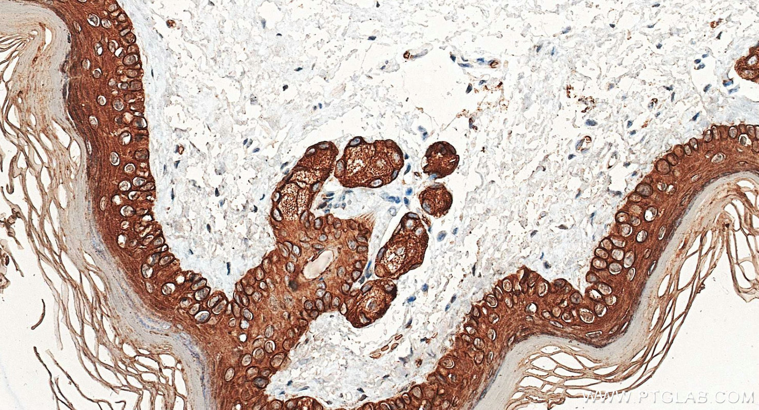 Immunohistochemistry (IHC) staining of mouse skin tissue using Cytokeratin 2e Polyclonal antibody (21725-1-AP)