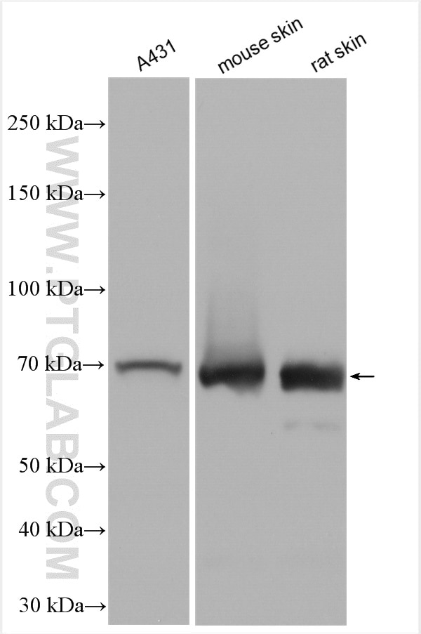 Western Blot (WB) analysis of various lysates using KRT2 Polyclonal antibody (21725-1-AP)