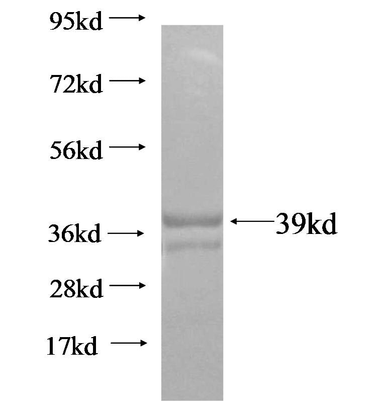 KRT2 fusion protein Ag16384 SDS-PAGE
