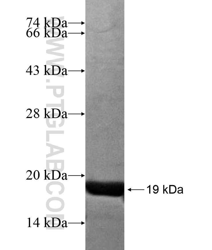 KRT2 fusion protein Ag17150 SDS-PAGE