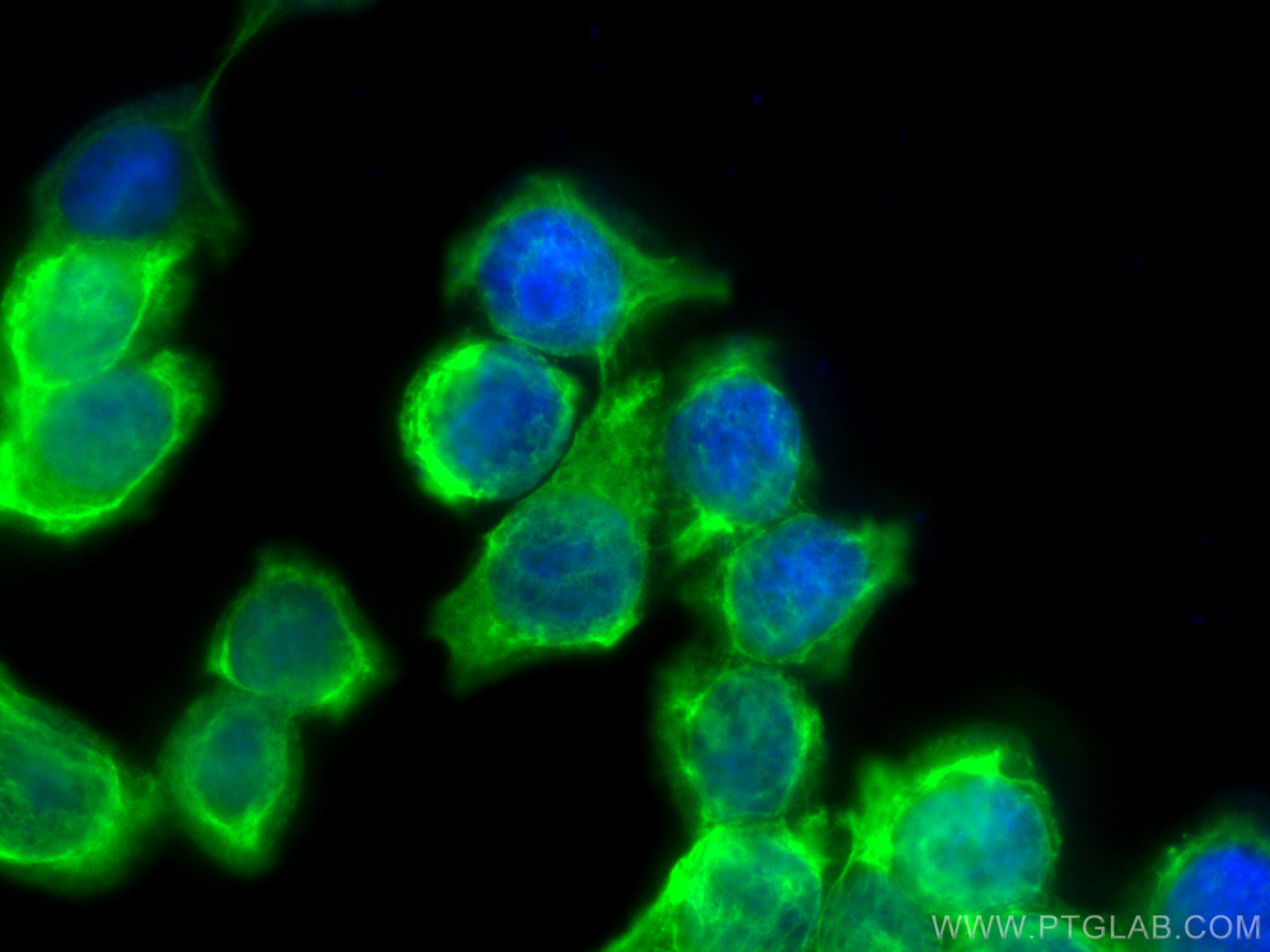 Immunofluorescence (IF) / fluorescent staining of HT-29 cells using Cytokeratin 20 Polyclonal antibody (17329-1-AP)