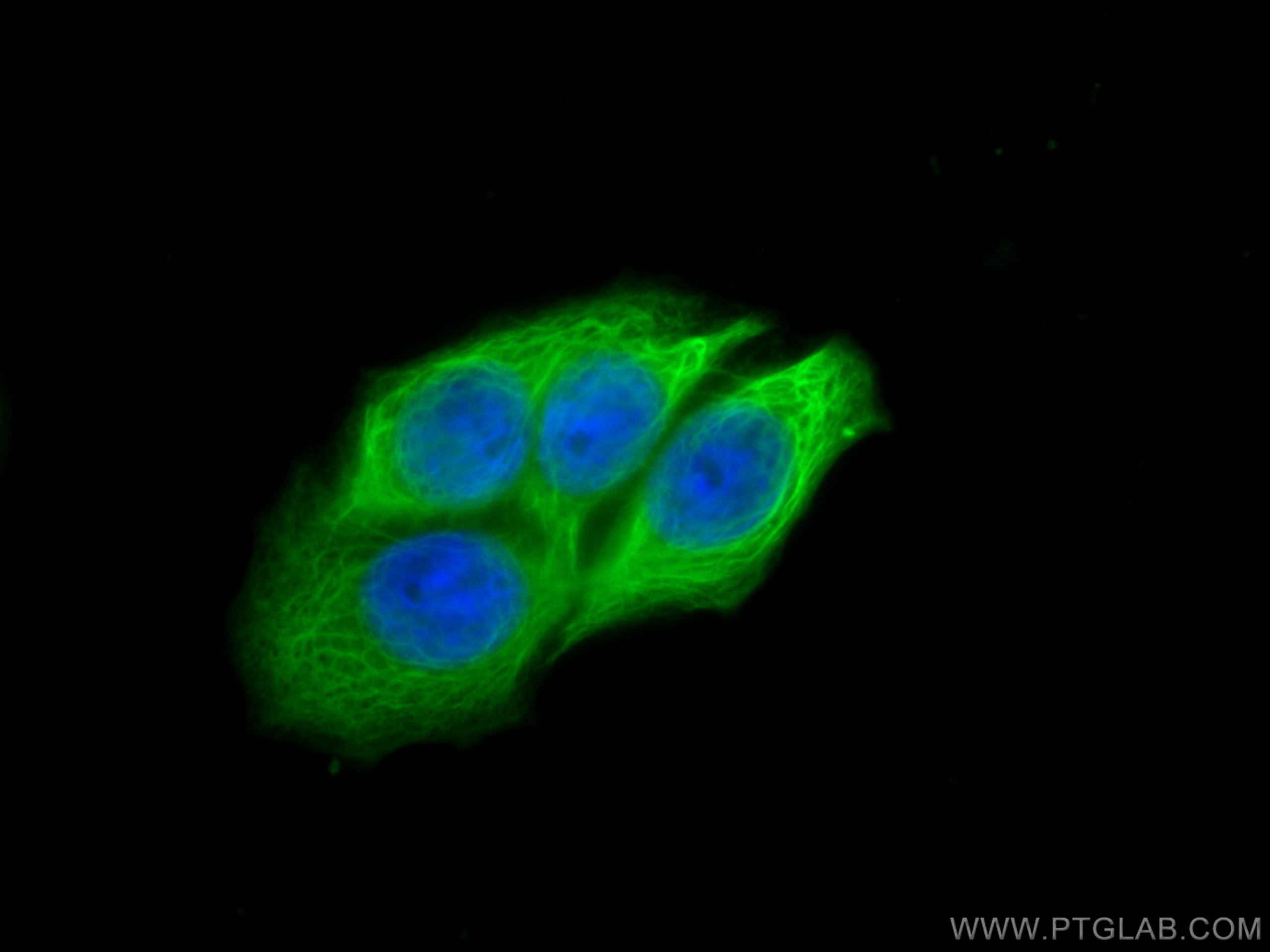 Immunofluorescence (IF) / fluorescent staining of HT-29 cells using Cytokeratin 20 Polyclonal antibody (17329-1-AP)