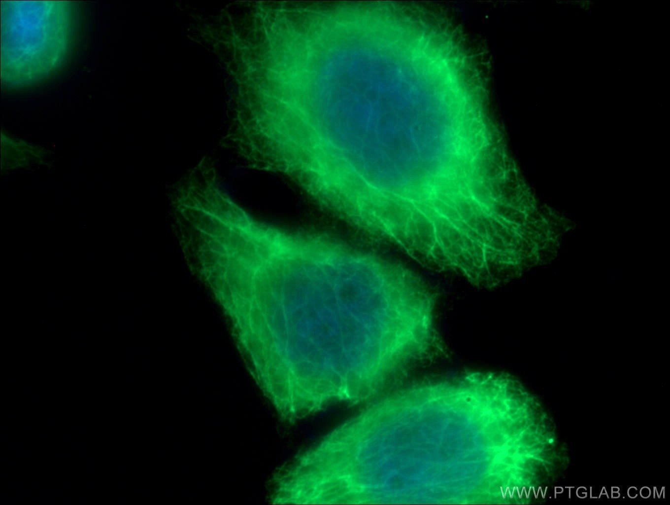 Immunofluorescence (IF) / fluorescent staining of HeLa cells using Cytokeratin 20 Polyclonal antibody (17329-1-AP)